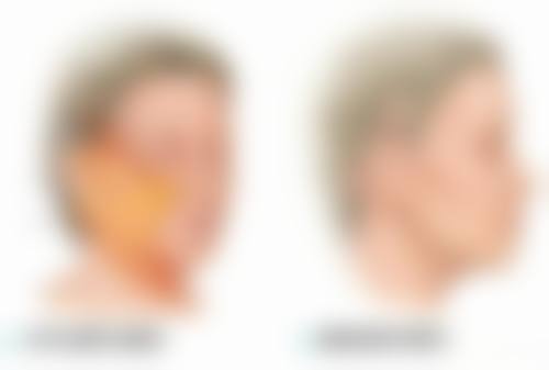 总结——郑州第一人民医院整形科怎么样？