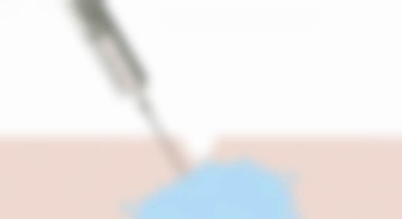 广州高尚医学美容中 心李翠华医生技术好不好？