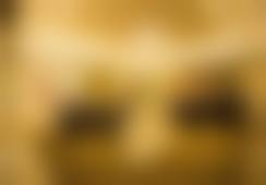 武汉希思特医疗美容医院黄巍医生技术好不好？