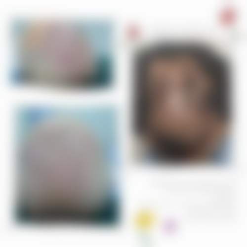 扬州蝶畔医疗美容诊所的价格表