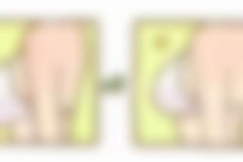 扬州蝶畔医疗美容诊所擅长的手术项目