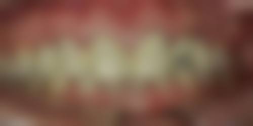 四、武汉睿优口腔开展的项目以及特色项目