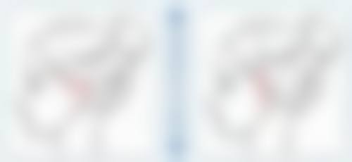 总结——韩国拉菲安整形外科文晶焕医生怎么样？