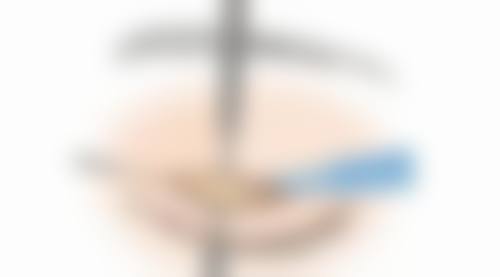 大连何医生鼻整形门诊部口碑如何？