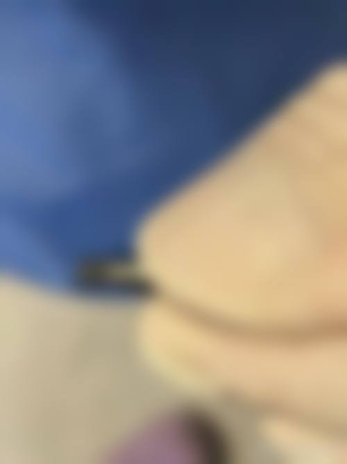 五、周升才医生擅长项目有哪些