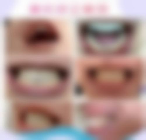 八、周升才医生口腔费用一览表