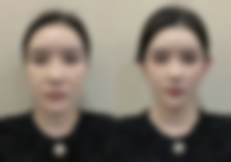 北京瀛美医疗美容整形门诊部口碑如何？