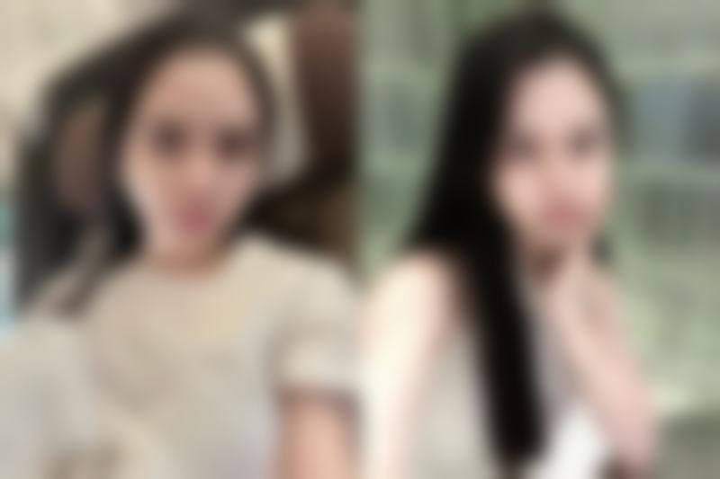 深圳贝加美医疗美容门诊部陈孟春医生技术好不好？