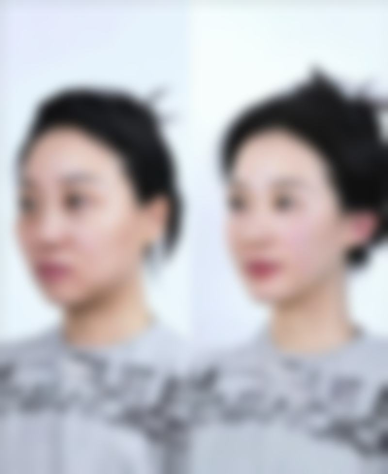 深圳儿童医院收费标准参考