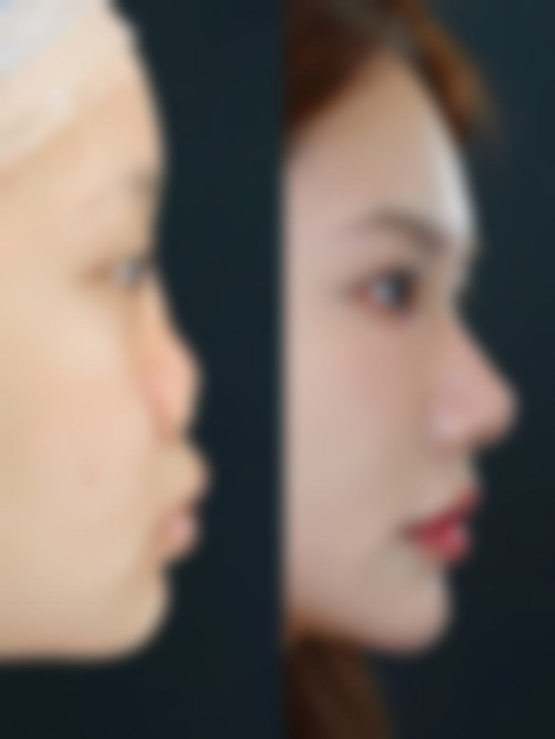 三门峡常亮整形美容诊所口碑如何？