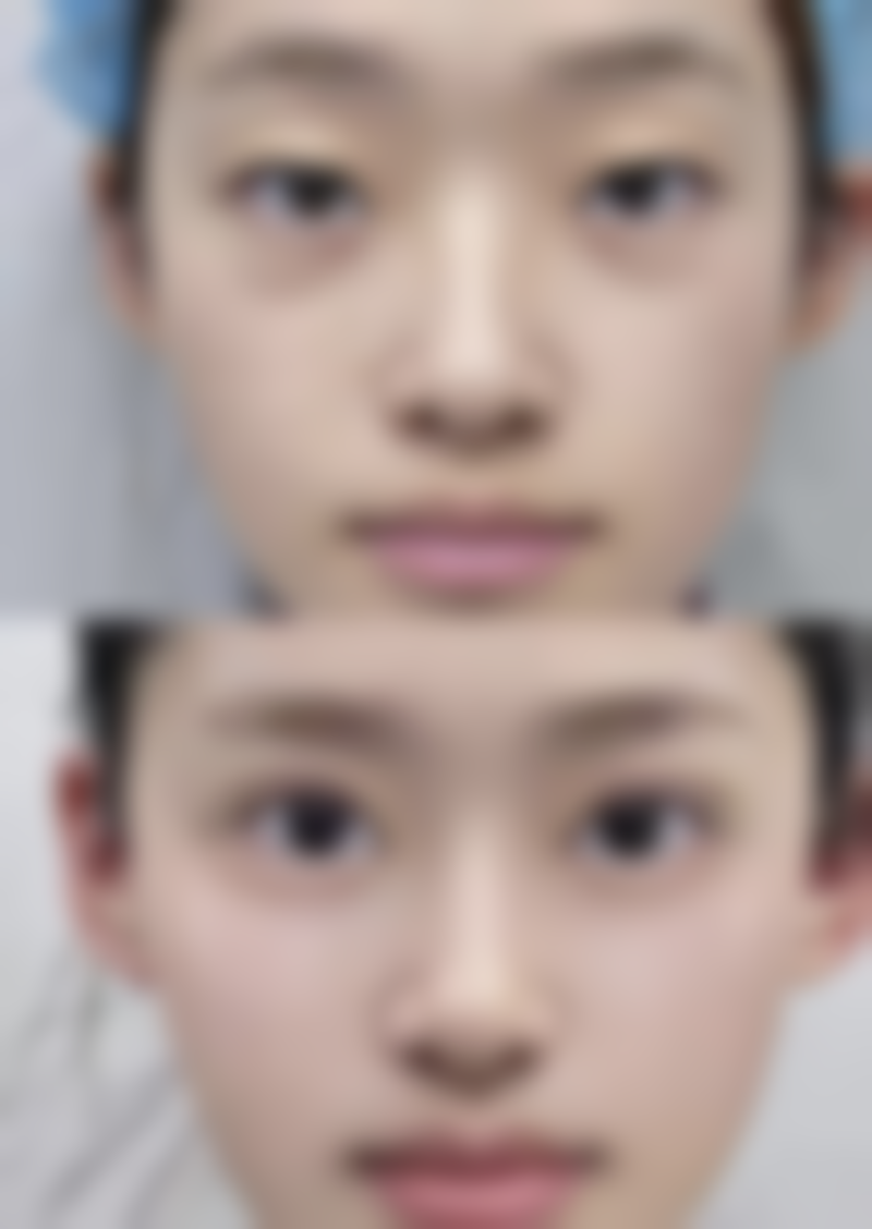 北京瀛美医疗美容整形门诊部电话号码及预约方法