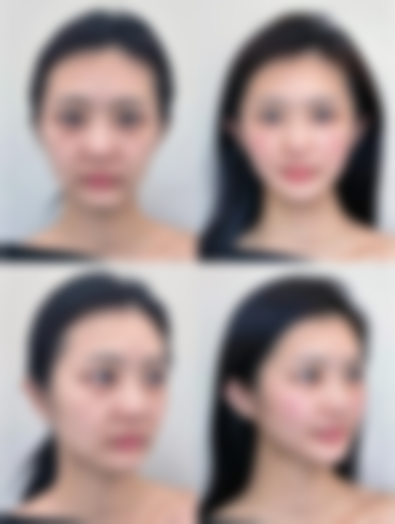 松原阳光整形医院硬件设备精良!