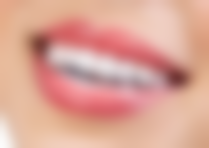 七、武汉睿优口腔价格表:(仅供参考)