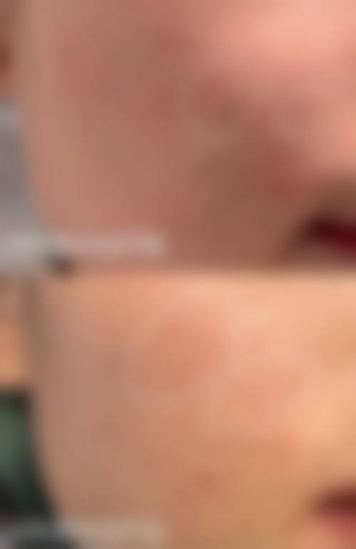 常州和平医院整形美容科口碑如何？