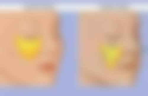 合肥奥美整形医疗美容门诊部医院技术好不好？