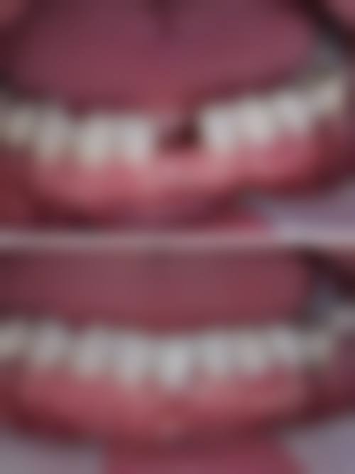 七、江西宜春于刚口腔价格表：（仅供参考）