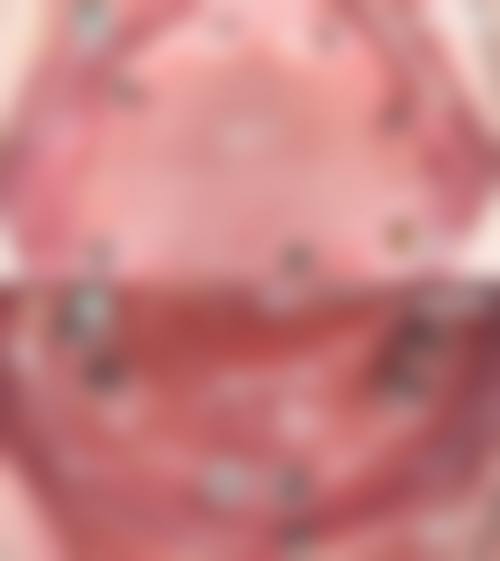 六、江西宜春于刚口腔怎么预约：