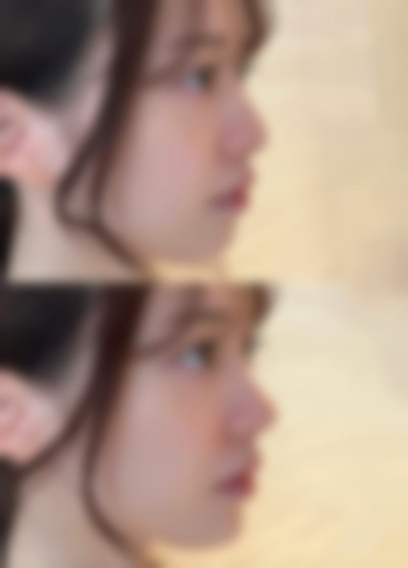 日照艾兰医疗美容诊所口碑如何？