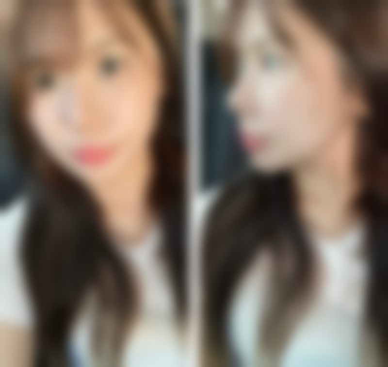 四、曲靖稷诱伊颜整形医院开展的项目以及特色项目