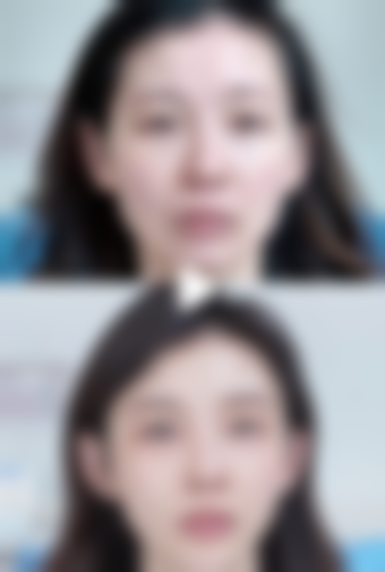 日照艾兰医疗美容诊所电话号码及预约方法