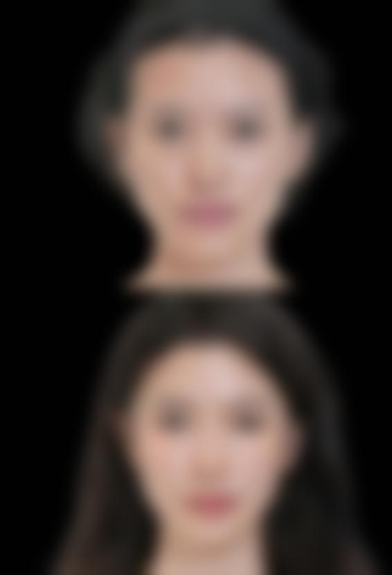 北京溪峰聚美仕整形医院尹云医生技术好不好？