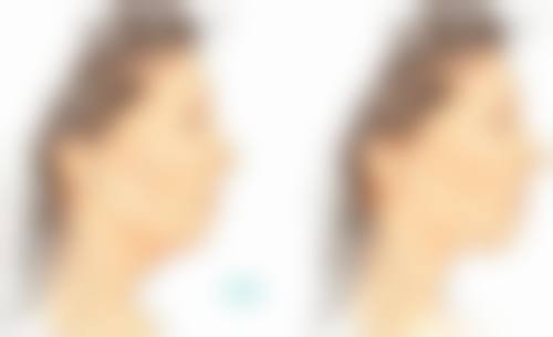 北京航天总医院整形科医院技术好不好？