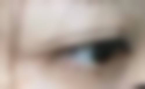 总结——武汉市三医院美容整形科怎么样？