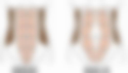 总结——丹东金澄美容医院穆成医生怎么样？