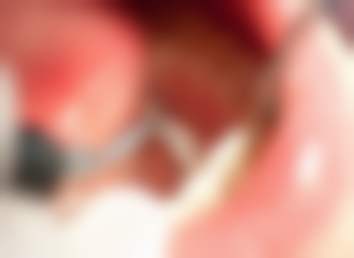 七、江苏苏州善尔美口腔价格表：（仅供参考）