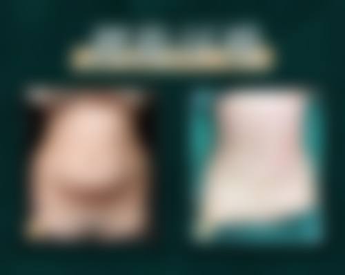 广州高尚医学美容中心栾翰林简介大公开！10余年经验定制麻醉，联合专家护航变美之路 