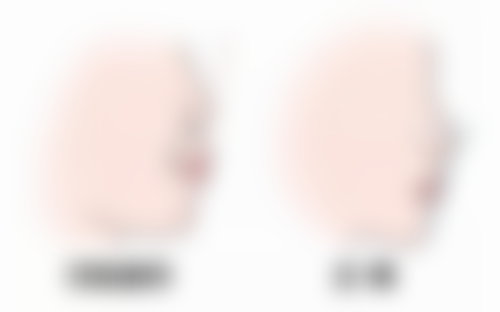 山东省立医院烧伤整形科霍然医生技术好不好？