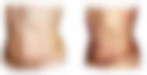 昆山美贝薇医疗美容诊所硬件设备精良！