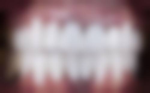 五、秦丽霞医生擅长项目有哪些