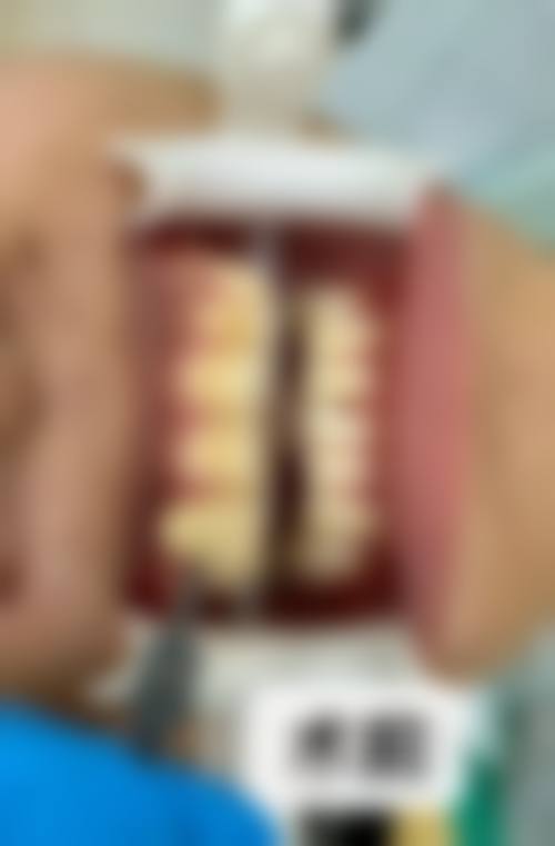 八、江苏苏州善尔美口腔用户真实实例