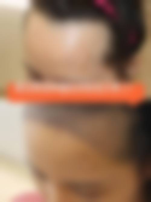 八、连云港国泰医院医疗美容科用户真实实例