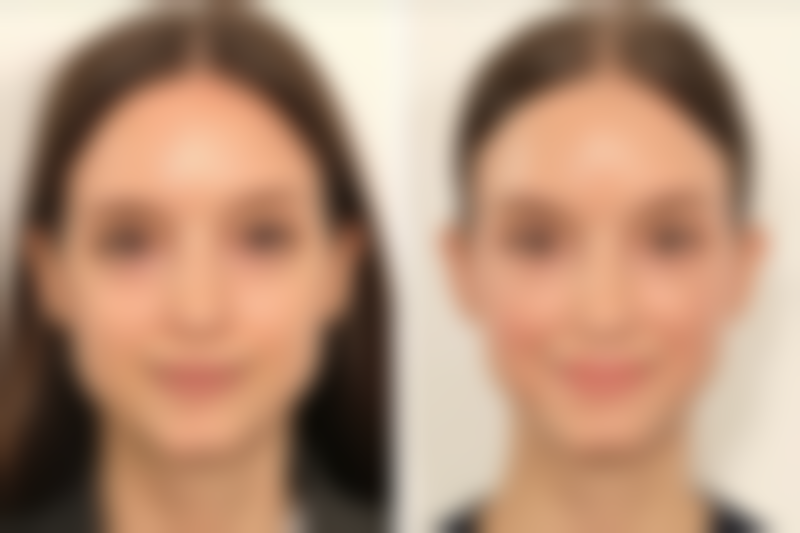 北京航天总医院整形科营业时间