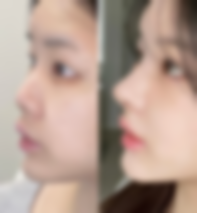 北京航天总医院整形科收费标准参考