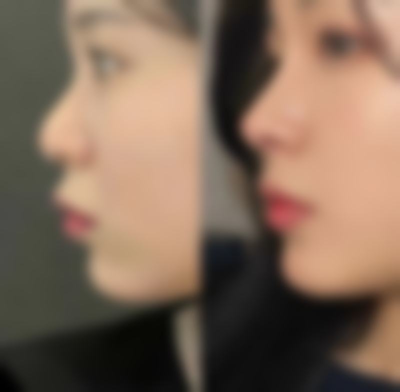 河池市第一人民医院皮肤美容科地址