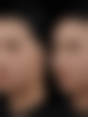 四、连云港国泰医院医疗美容科开展的项目以及特色项目