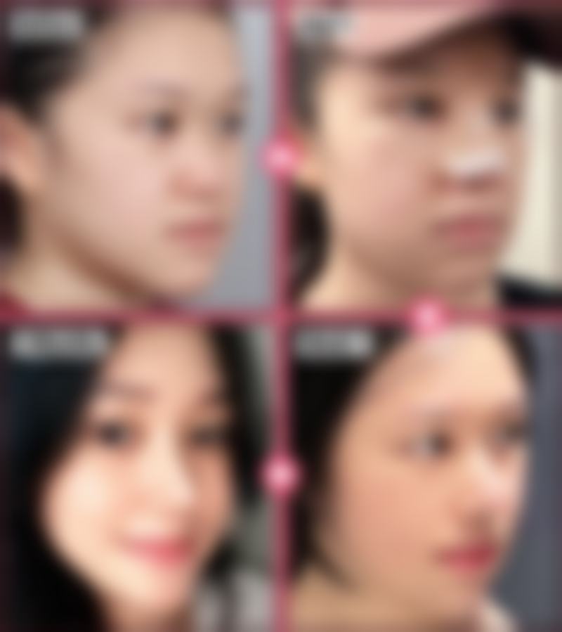 总结——延吉董昌林医学美容医院李英玉医生怎么样？