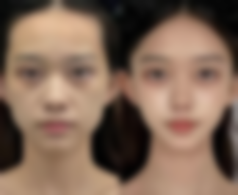 七、连云港国泰医院医疗美容科价格表：（仅供参考）