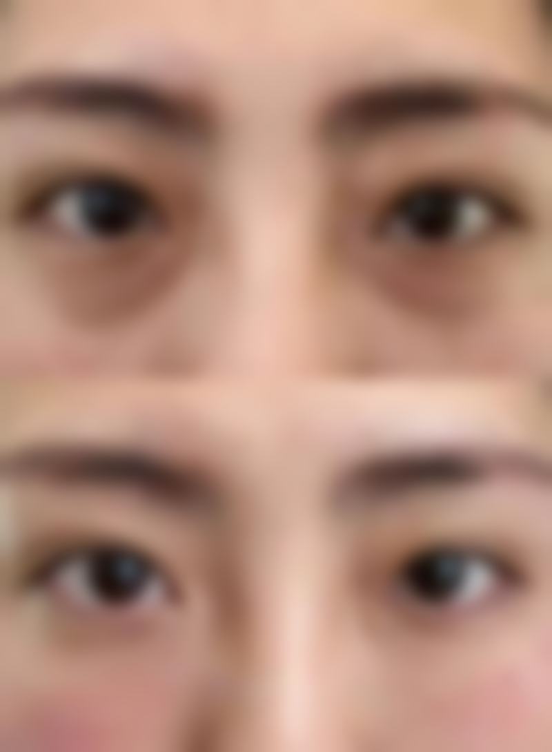 武汉市三医院美容整形科医院技术好不好？