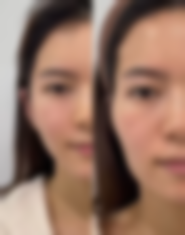 宁波市中医院(医疗美容)口碑如何？