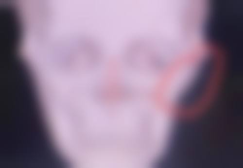 沈阳翌禾植发医院电话号码及预约方法