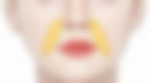 三十岁做双眼皮的手术方式