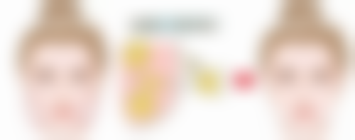 选择双眼皮形态要注意什么