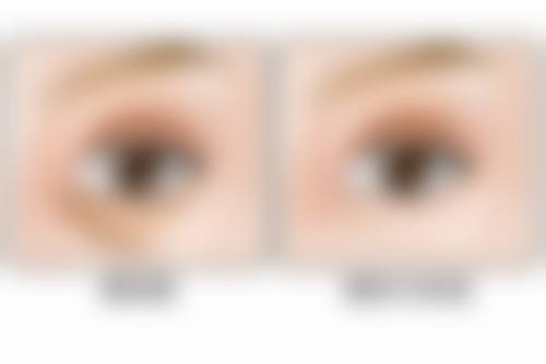 一些小妙招消除黑眼圈和眼袋