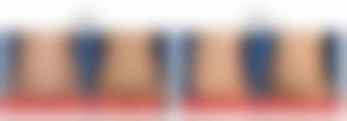 重度情况的医疗干预