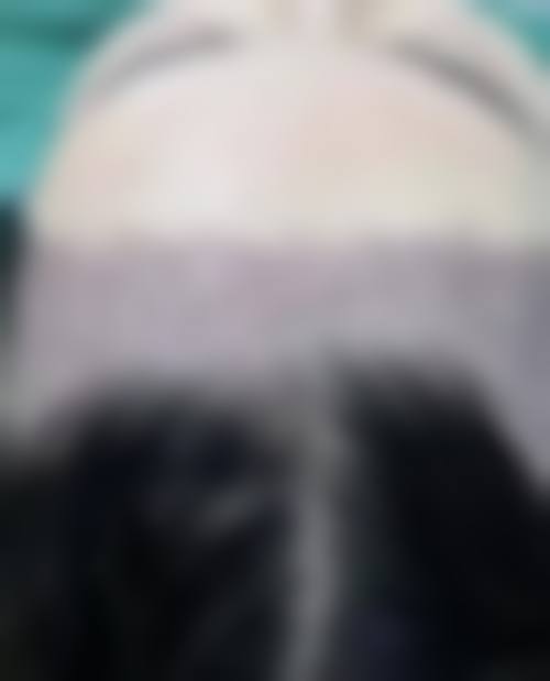 五、申枓翰医生擅长项目有哪些