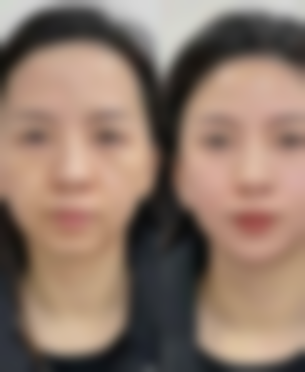 深圳岭南医院医疗美容科医院技术好不好？